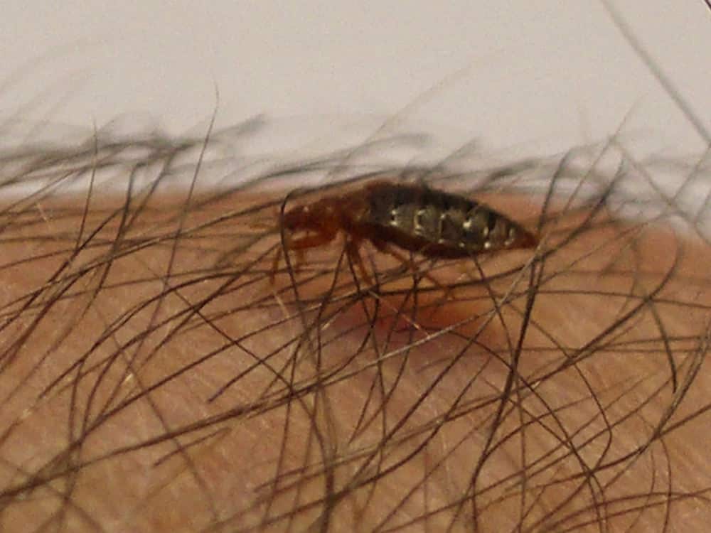 Can bed bugs live in your hair like lice