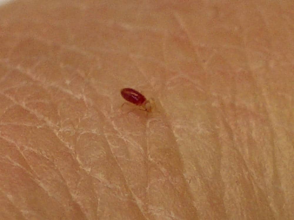 Best Bed Bug Repellents For The Skin